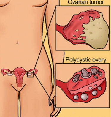 ���ݴ���