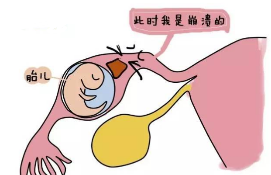 ���ݴ���