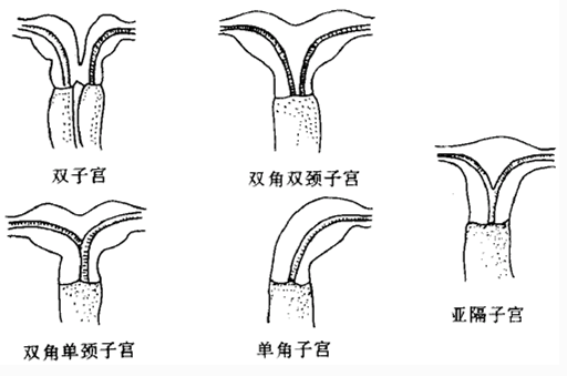 ���ݴ���