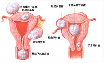 ���ݴ���