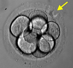 ���ݴ���