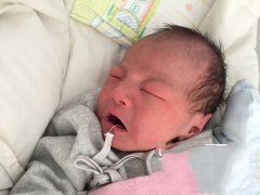 �����Ⱦɫ���쳣�Թܵ���