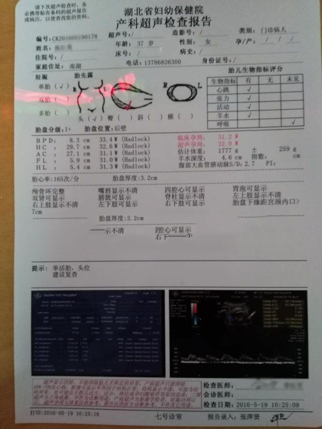 ���ݴ���