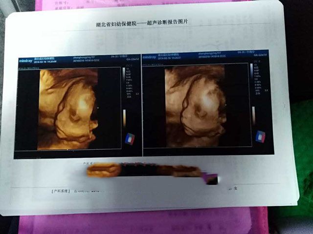 ���ݴ���